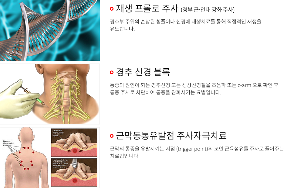 비수술적 치료